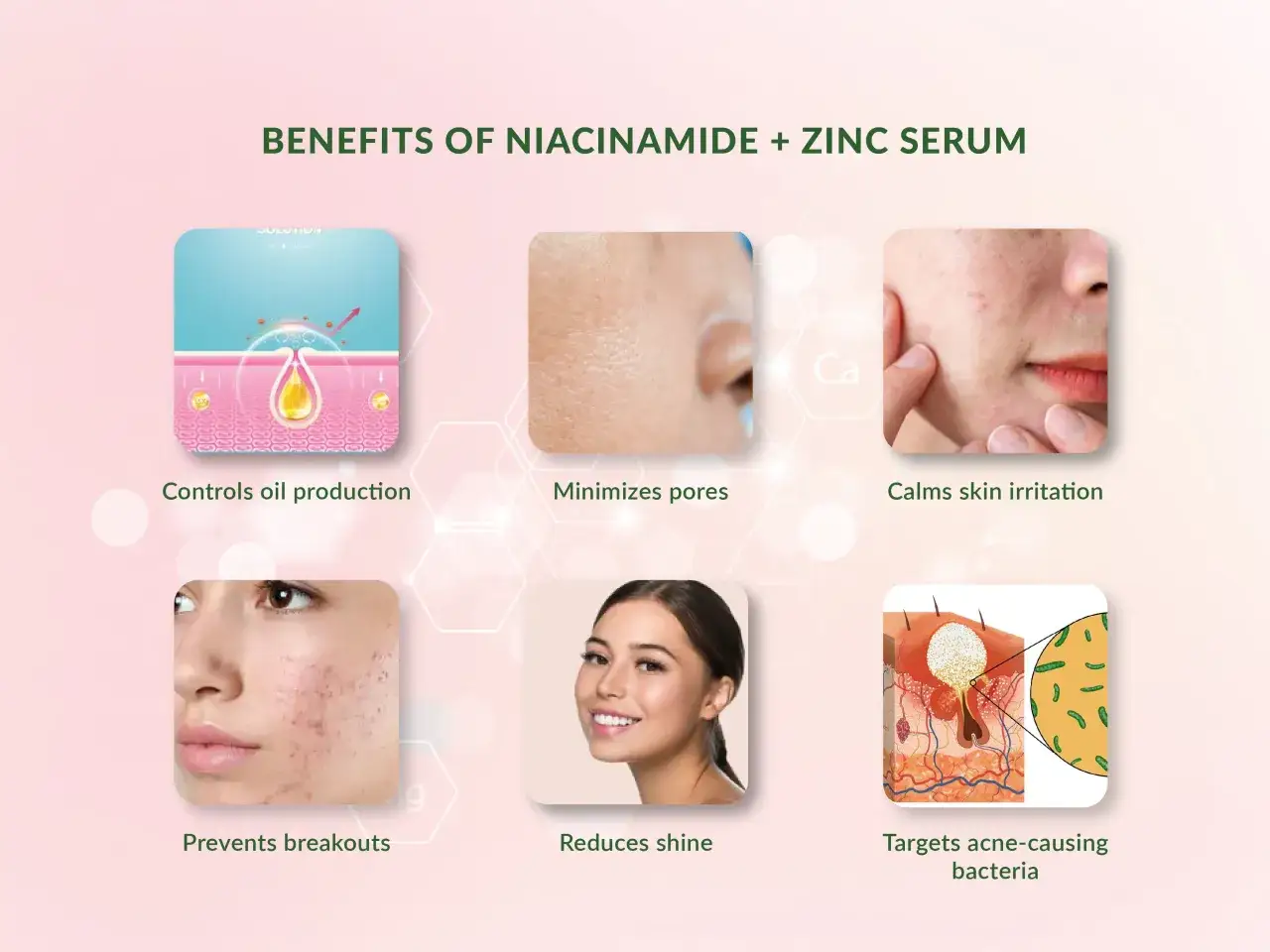Le niacinamide aide &agrave; r&eacute;guler la production de s&eacute;bum, minimisant les pores et les imperfections pour une peau grasse &eacute;clatante.